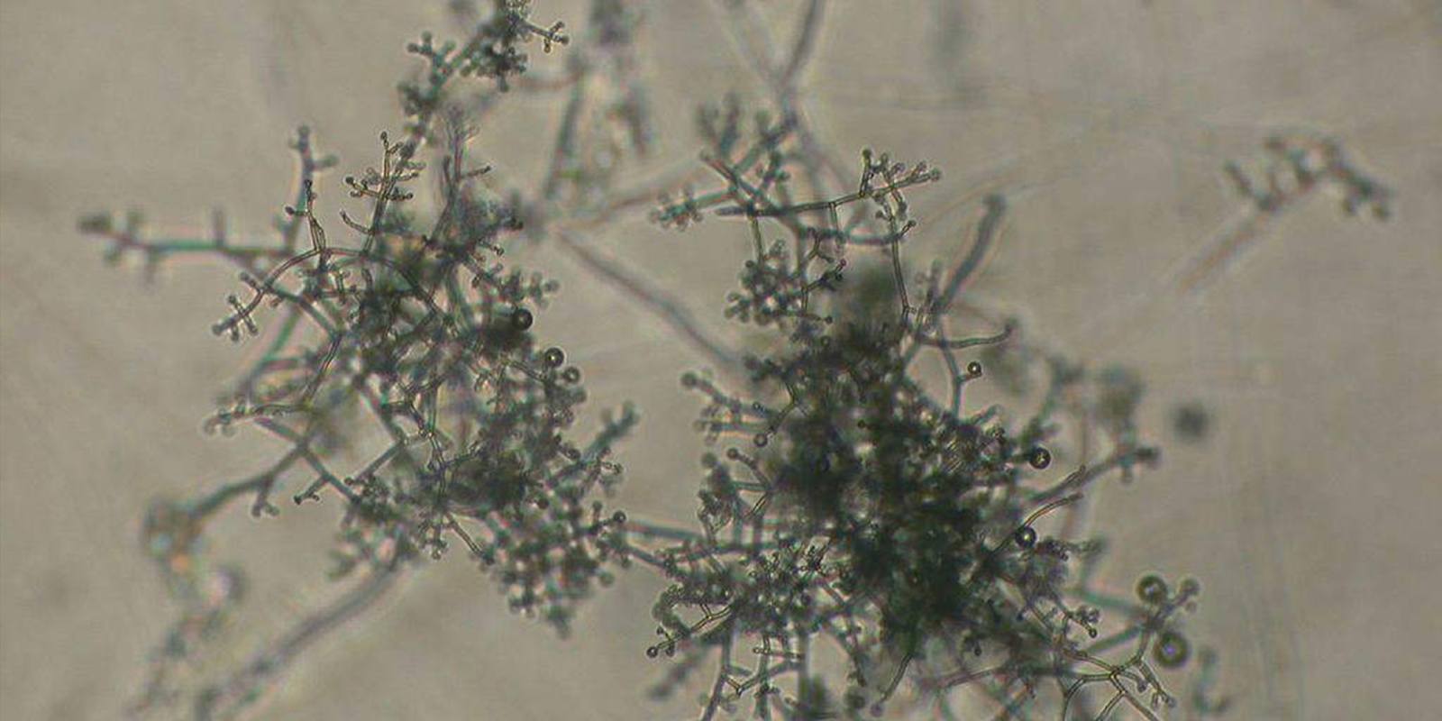 Trichoderma why is it useful in cannabis cultivation